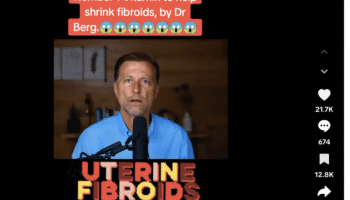 Eric Berg uterine fibroids vitamin D